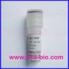 HCG Antigen