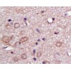 GLUT1 Antibody