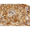 TIMP-1 Antibody