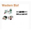 WESTERN BLOT 实验