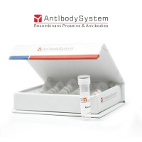 Recombinant Human PTX3 Protein, C-His (Active)